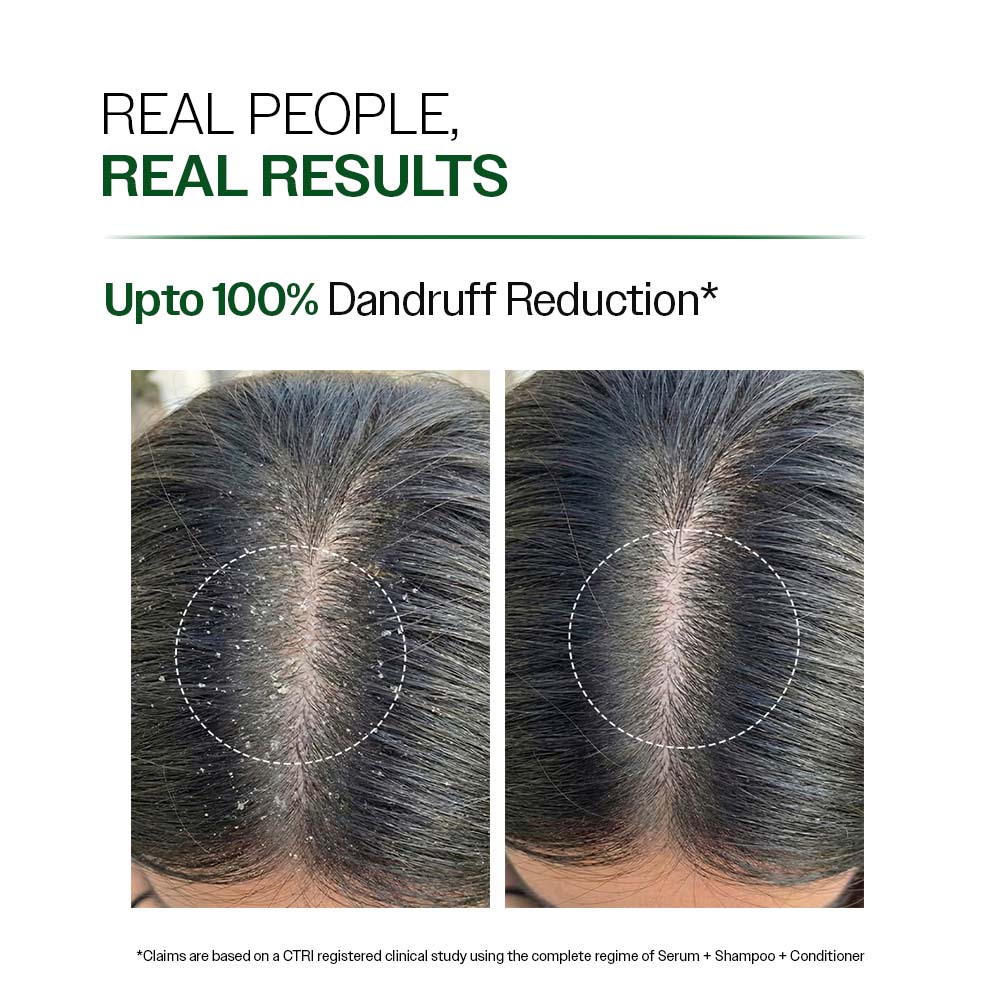 Anti Dandruff Shampoo with Salicylic Acid & Biotin- 250ml