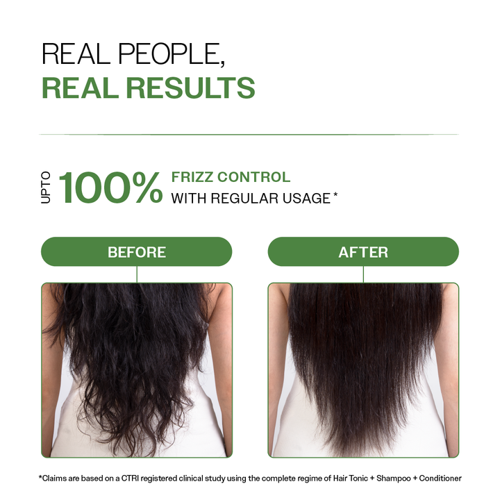Anti-Dandruff Hair Conditioner with Biotin, Salicylic Acid & Rosemary