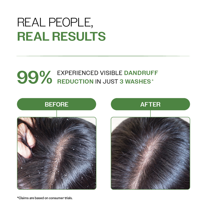 Anti Dandruff Shampoo with Salicylic Acid & Biotin- 250ml