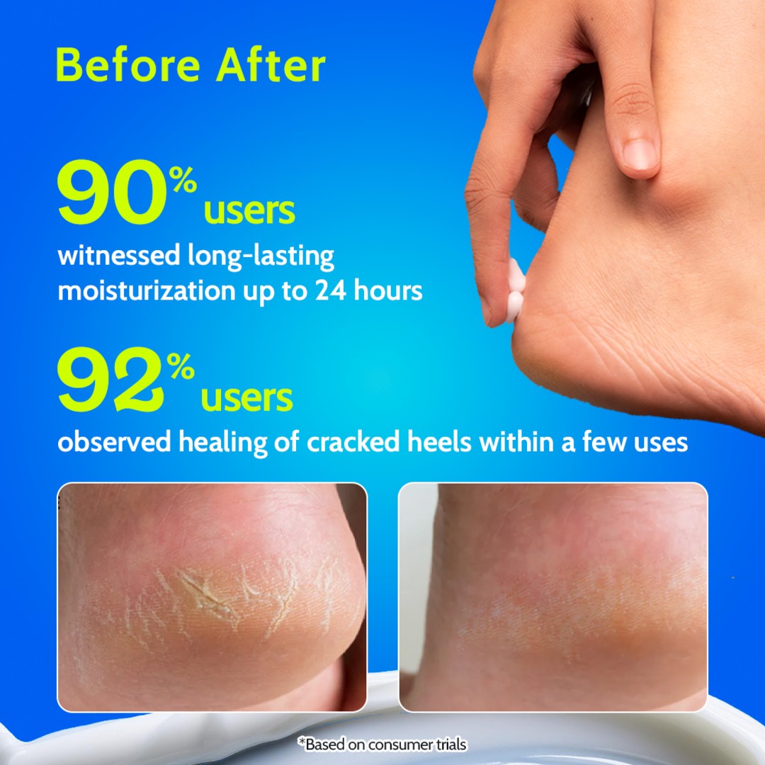Foot Cream for Cracked Heels Diabetic Foot
