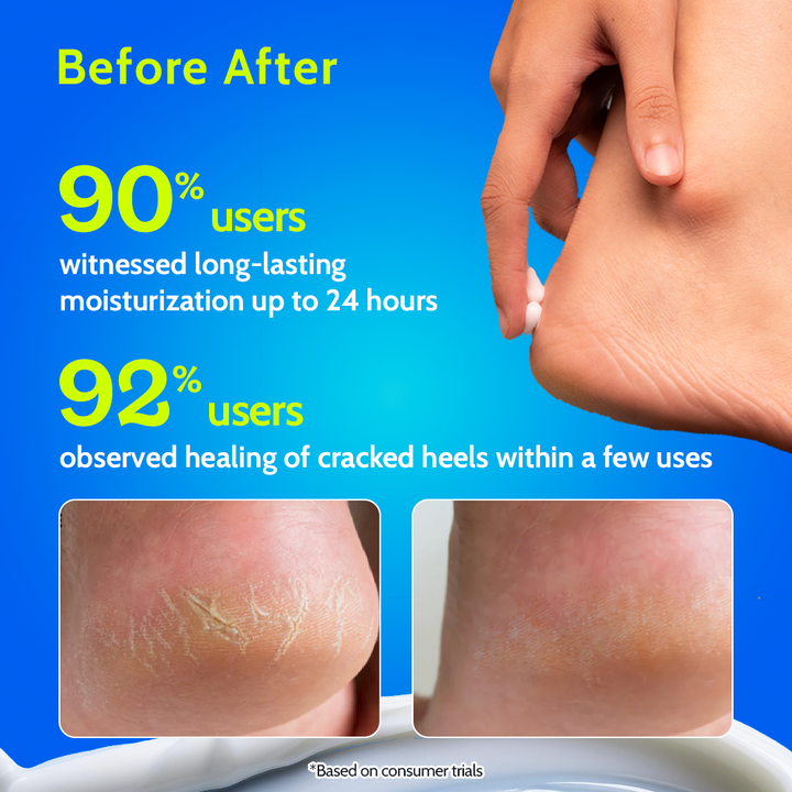 Foot Cream for Cracked Heels & Diabetic Foot