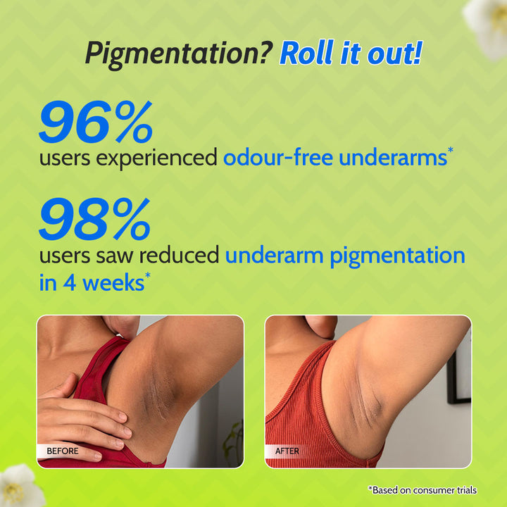 5% AHA Underarm Roll On for Odour Control & Pigmentation (White Jasmine) - 75 ml