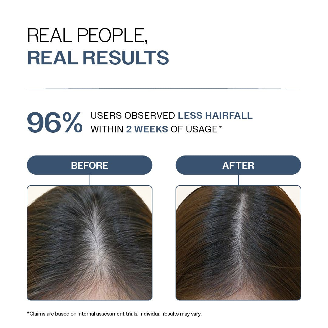 Hair Fall Control Shampoo with Peptides - 100 ml