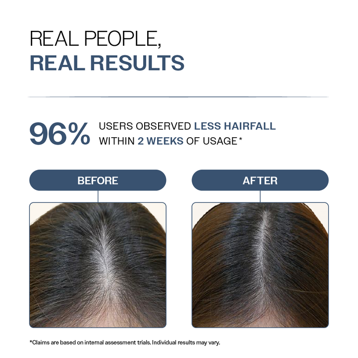 Hair Fall Control Shampoo with Peptides - 100 ml