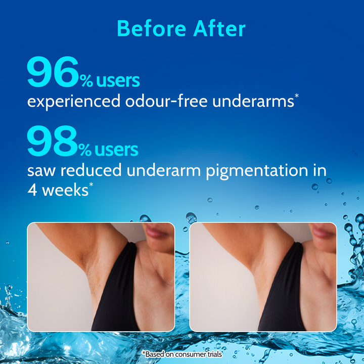 Underarm Roll On for Odour Control & Pigmentation