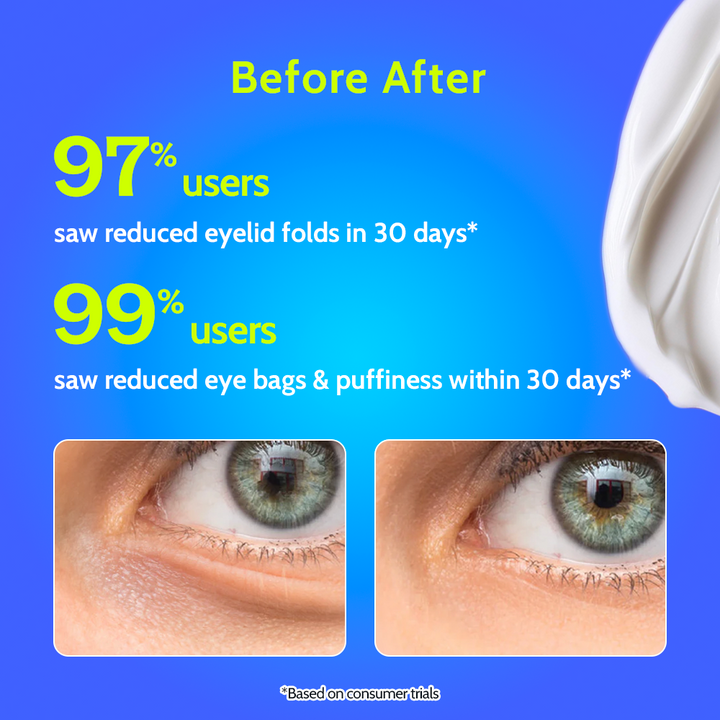 Under Eye Cream for Dark Circles Removal & Wrinkles