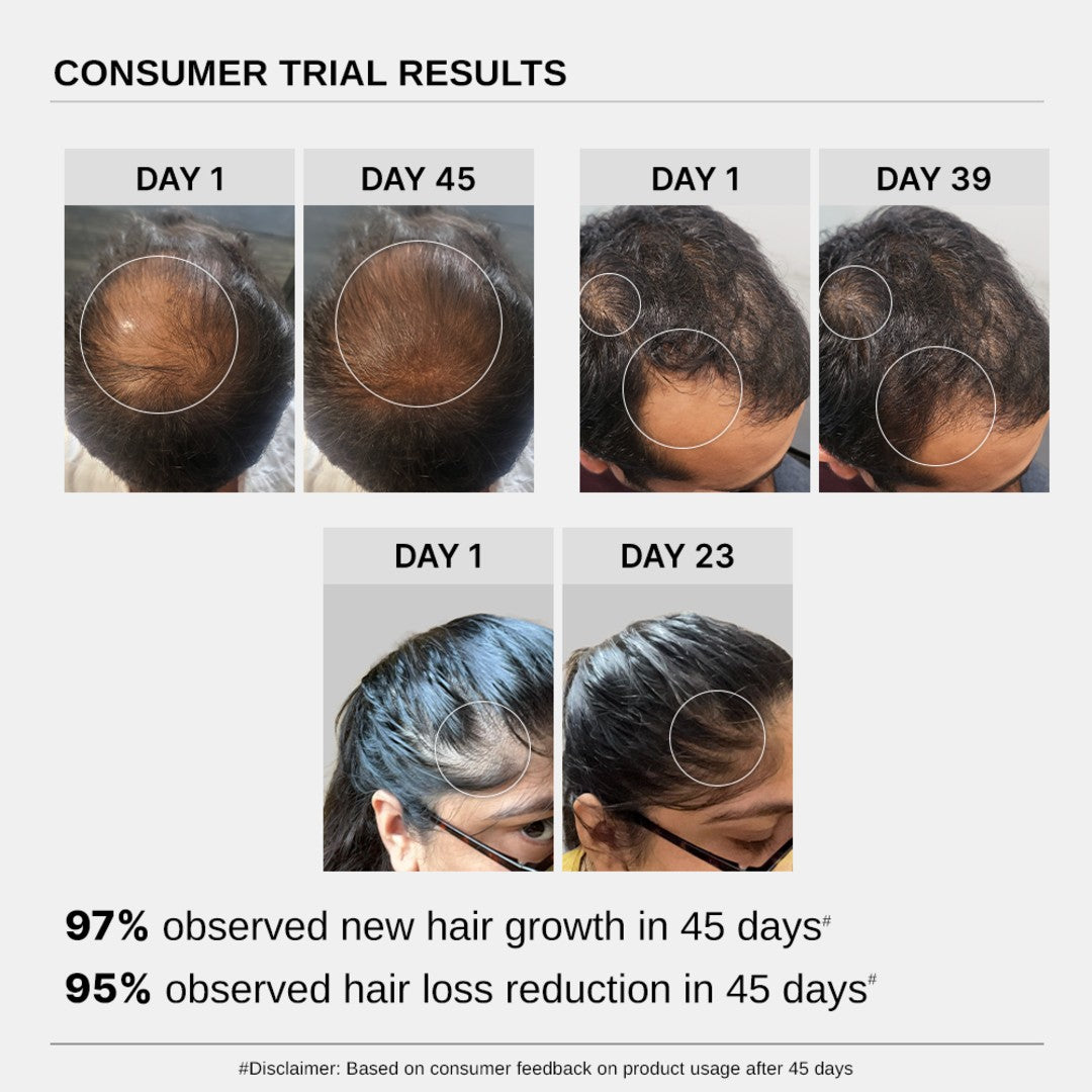 Hair Growth Serum (Pack of 2) & Scalp Massager Hair Growth Combo