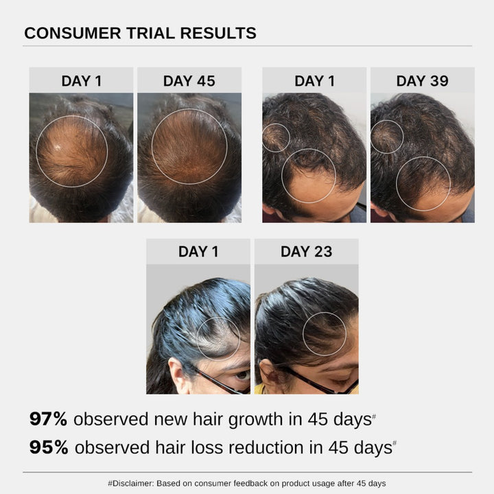 Hair Growth Serum (Pack of 2) & Scalp Massager Hair Growth Combo