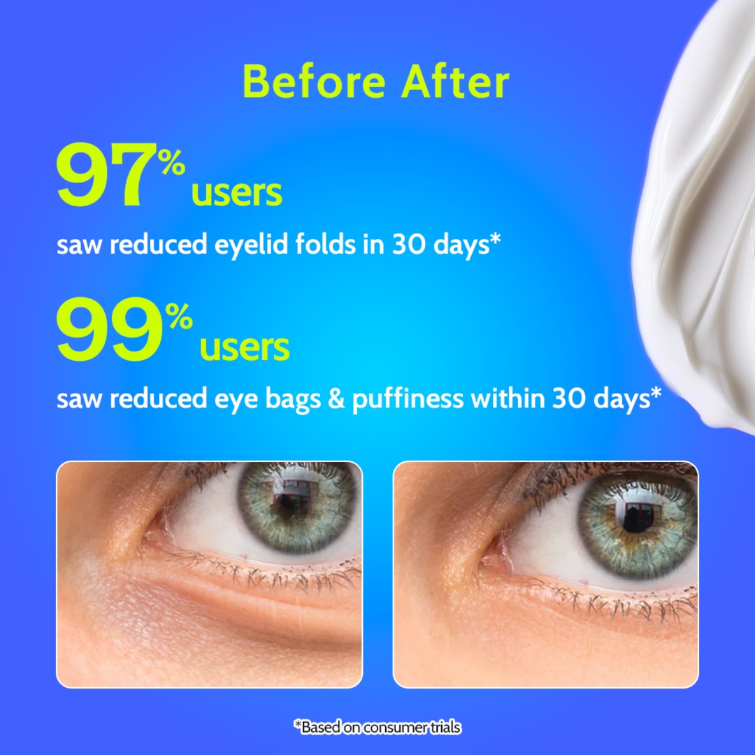 Under Eye Cream for Dark Circles Removal & Wrinkles