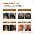 Advanced Hair Growth Serum With 3% Redensyl, 4% Anagain, & 1% Capilia Longa - 30 ml