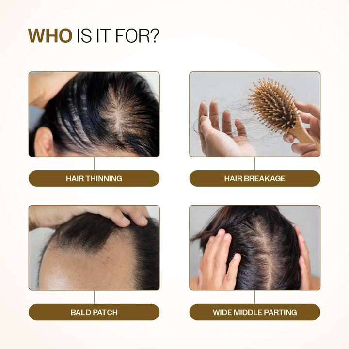 Advanced Hair Growth Serum with 3% Redensyl, 4% Anagain, 3% Bicapil & 1% Capilia Longa - 30 ml