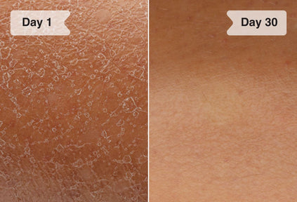 Results before and after