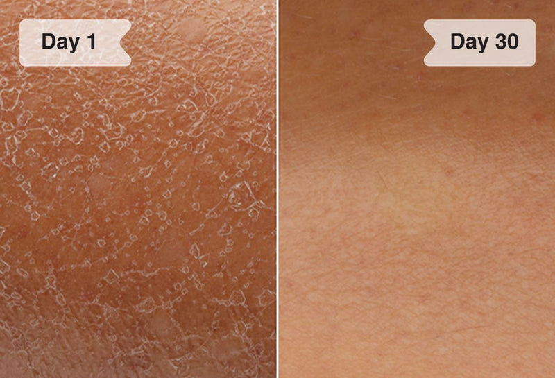Results before/after