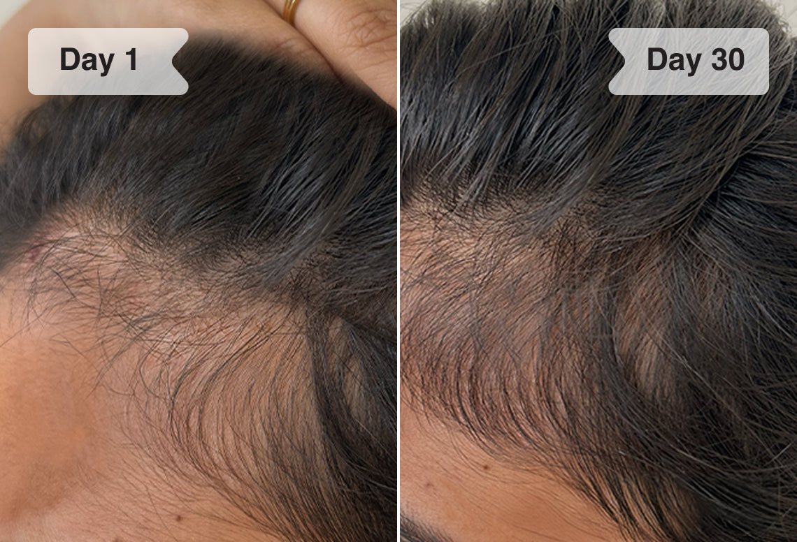 Results before/after