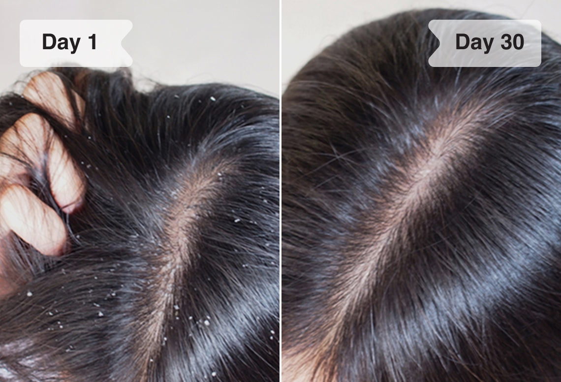 Results before/after
