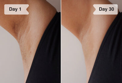 Results before and after