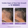 Rosemary & Hibiscus Hair Growth Oil with Redensyl & Biotin - 100
