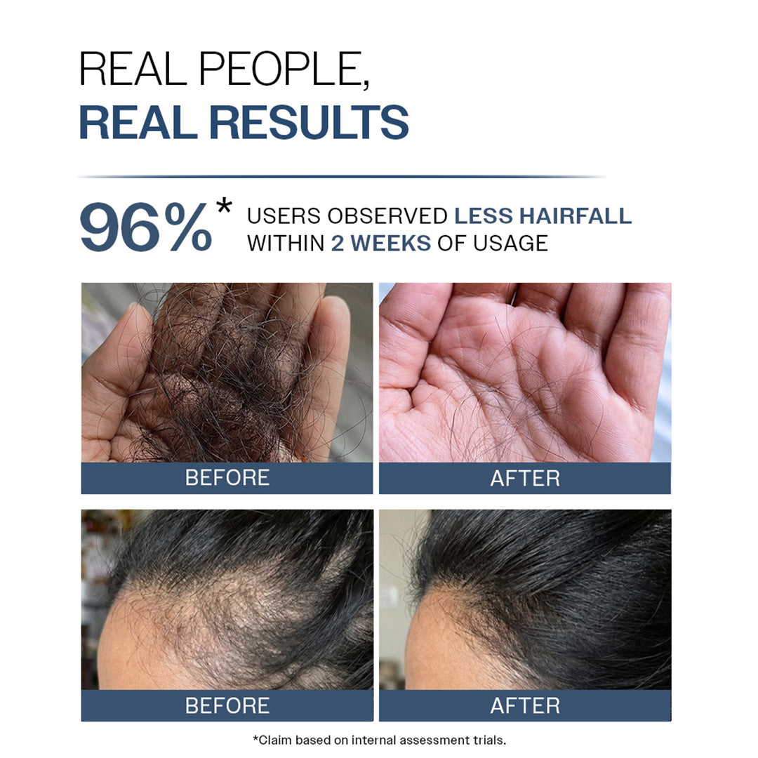 Anti-Hair Fall Shampoo with Peptides  | 5X Hairfall Control- 750 ml