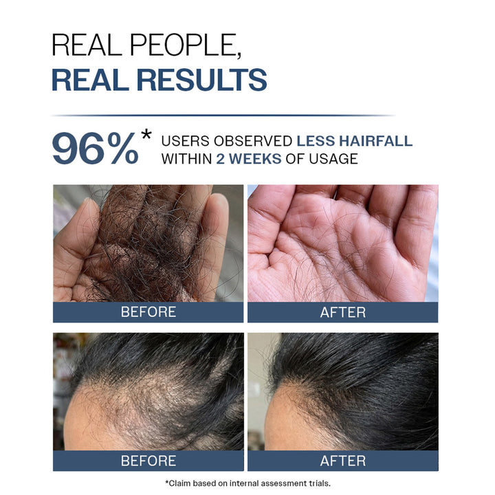 Anti-Hair Fall Shampoo with Peptides  | 5X Hairfall Control- 750 ml