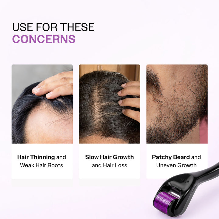 derma roll with q10 & l-carnitine Amazon.com: Dremenester Roller for Body, Hair and Sculp, 540 Titanium Microneedle Dermal Skincare, Microneedling Roller for Men and Women Storage Case (0.25mm) : Beauty Personal Care Derma Roller for Hair Growth