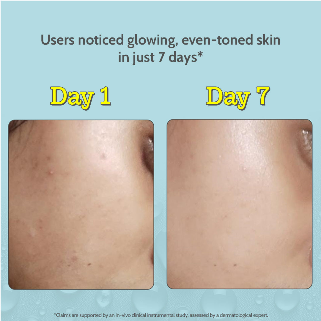 10% Vitamin C Face Serum for Glowing & Bright Skin - 10ml