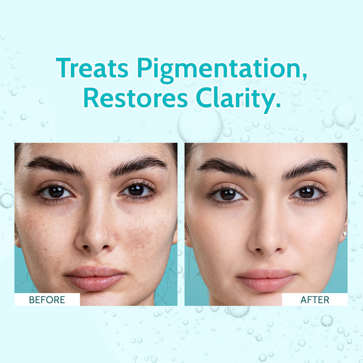 10% Niacinamide Clarifying Face Serum - 10 ml