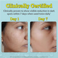 10% Vitamin C Serum for Glowing & Bright Skin - 10 ml