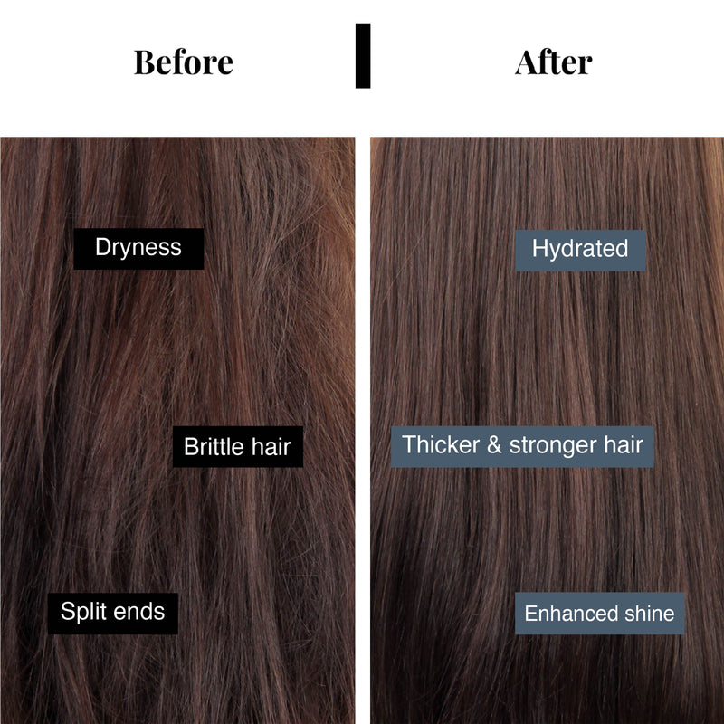 Anti Hair Fall Kit <br> (Mask | Shampoo | Tonic)