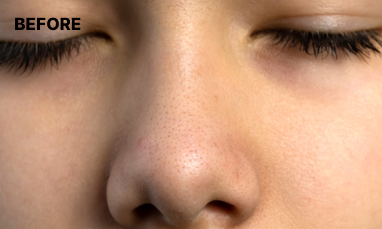 Exfoliating Peeling Gel main image 1