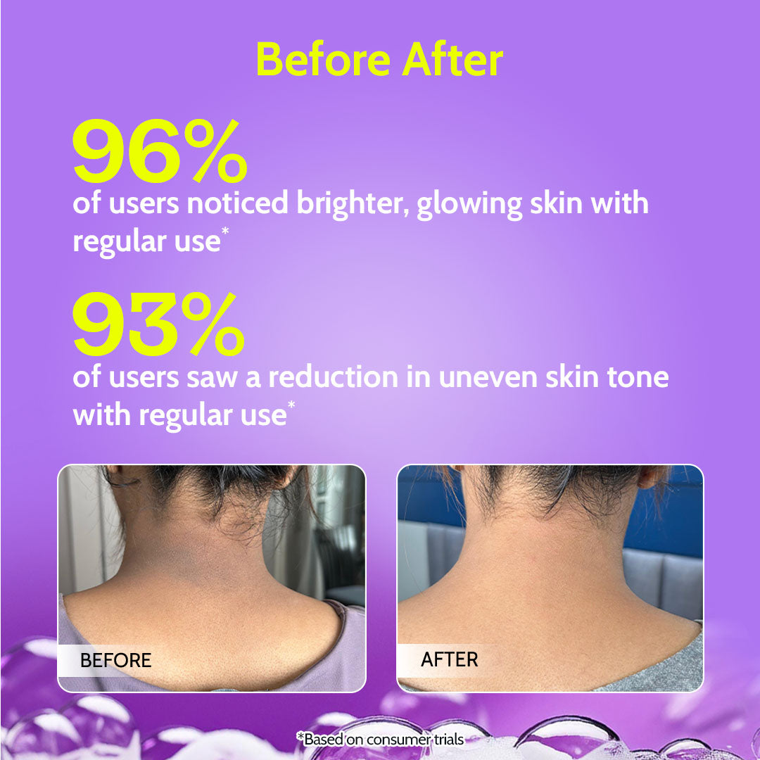 Brightening Body Wash Camu Camu & Alpha Arbutin | 236 mL