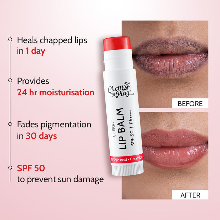 Cherry Lip Balm for Chapped & Pigmented Lips | SPF 50 PA++++ & Kojic Acid