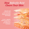 2% Salicylic Acid Face Serum With Lactic Acid | For Acne Control  - 30 ml