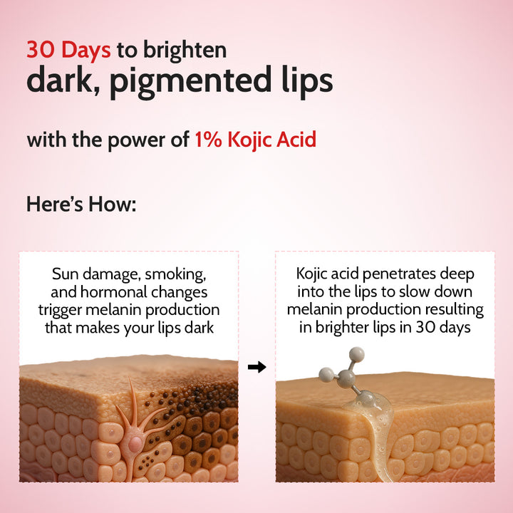 Cherry Lip Balm for Chapped & Pigmented Lips | SPF 50 PA++++ & Kojic Acid