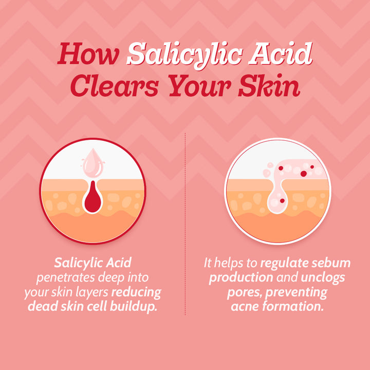 2% Salicylic Acid Face Serum With Lactic Acid | For Acne Control  - 30 ml