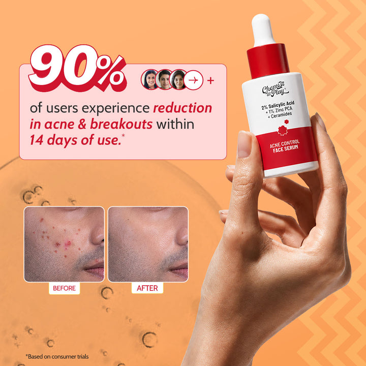 2% Salicylic Acid Face Serum With Lactic Acid | For Acne Control  - 30 ml