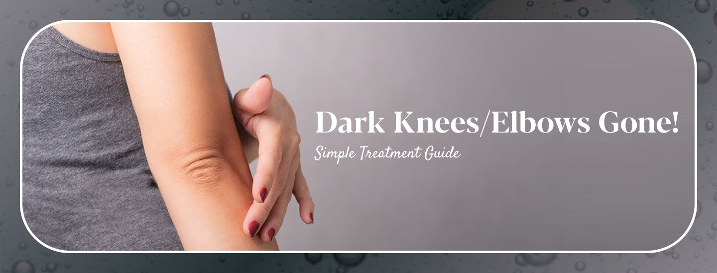 Dark Knees & Elbows: Causes, Treatment & Prevention Tips