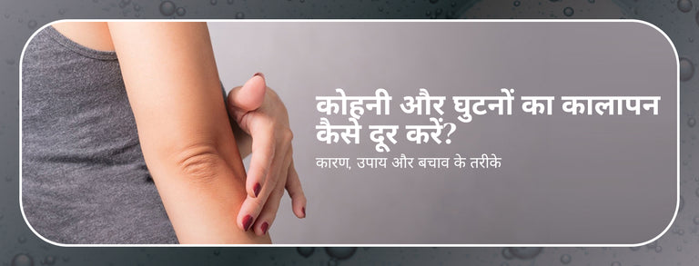 कोहनी और घुटनों का कालापन कैसे दूर करें? कारण, उपाय और बचाव के तरीके