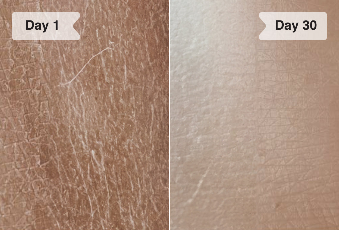 Results before/after