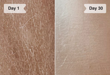 Results before and after