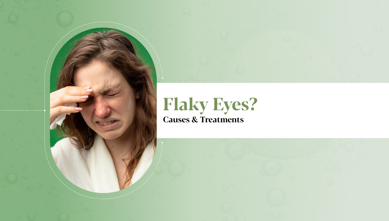 Ignoring Dandruff? Here’s How It Can Affect your Eyes & Scalp