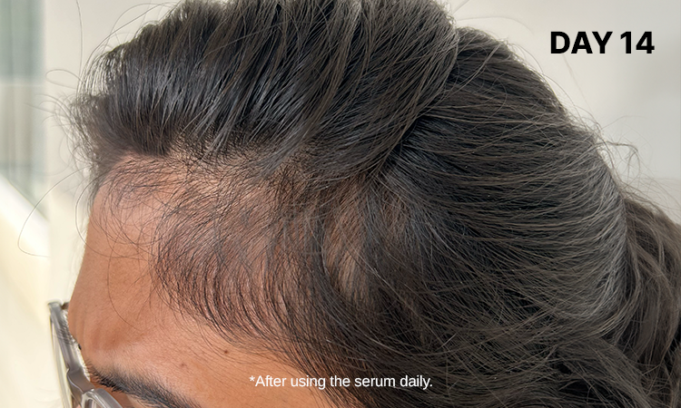 Hair Growth Serum for Strong, Healthy & Thick Hair | Bare Anatomy ...