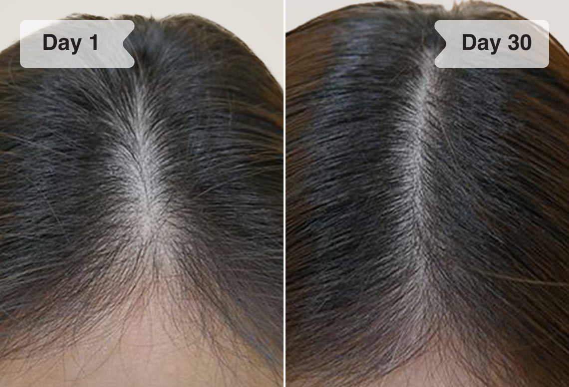 Results before/after