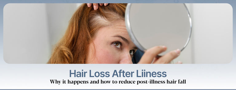 Hair Loss After Illness: Why It Happens and How to Reduce Post-Illness Hair Fall