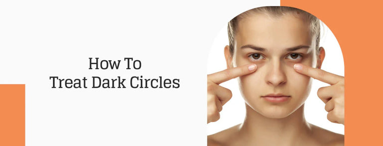 How To Treat Dark Circles Under The Eyes