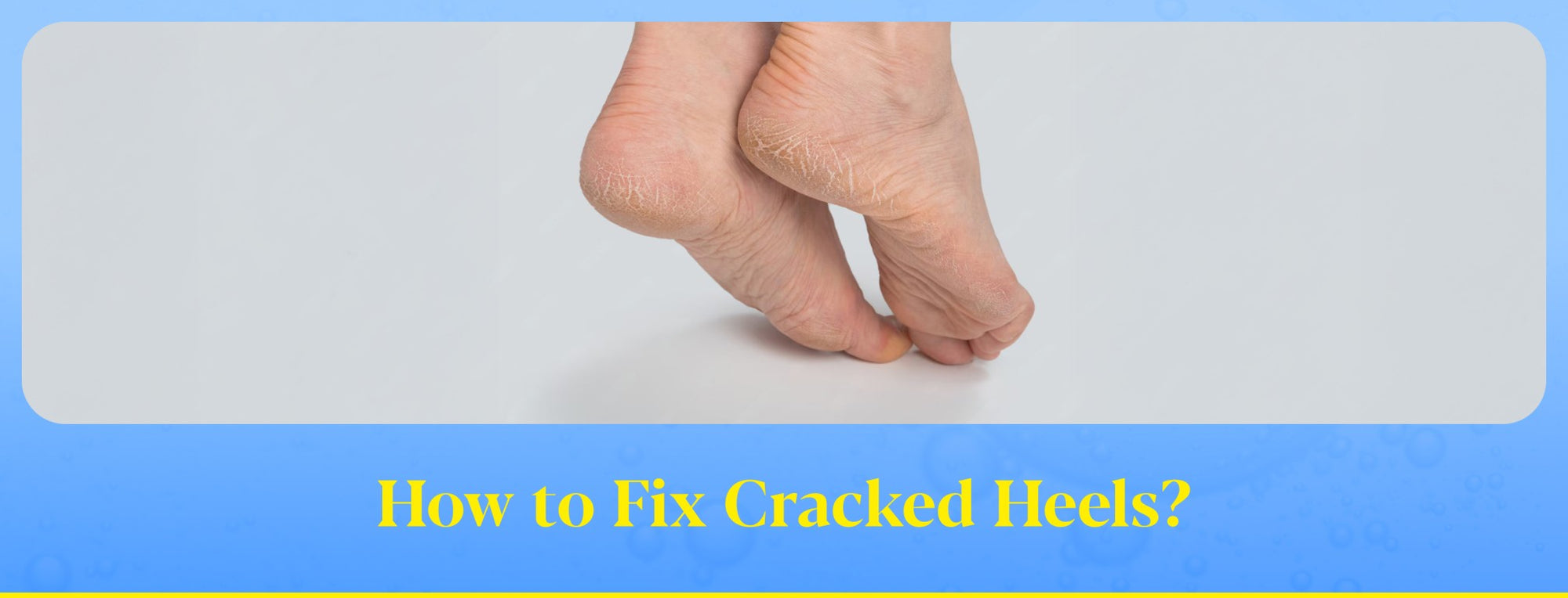 How to Fix Cracked Heels Permanently: Doctor’s Guide to Smooth & Healthy Feet