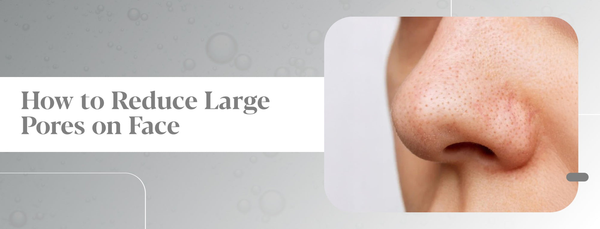 Pores on Your Face: Real Ways to Minimize, Shrink & Tighten Pores