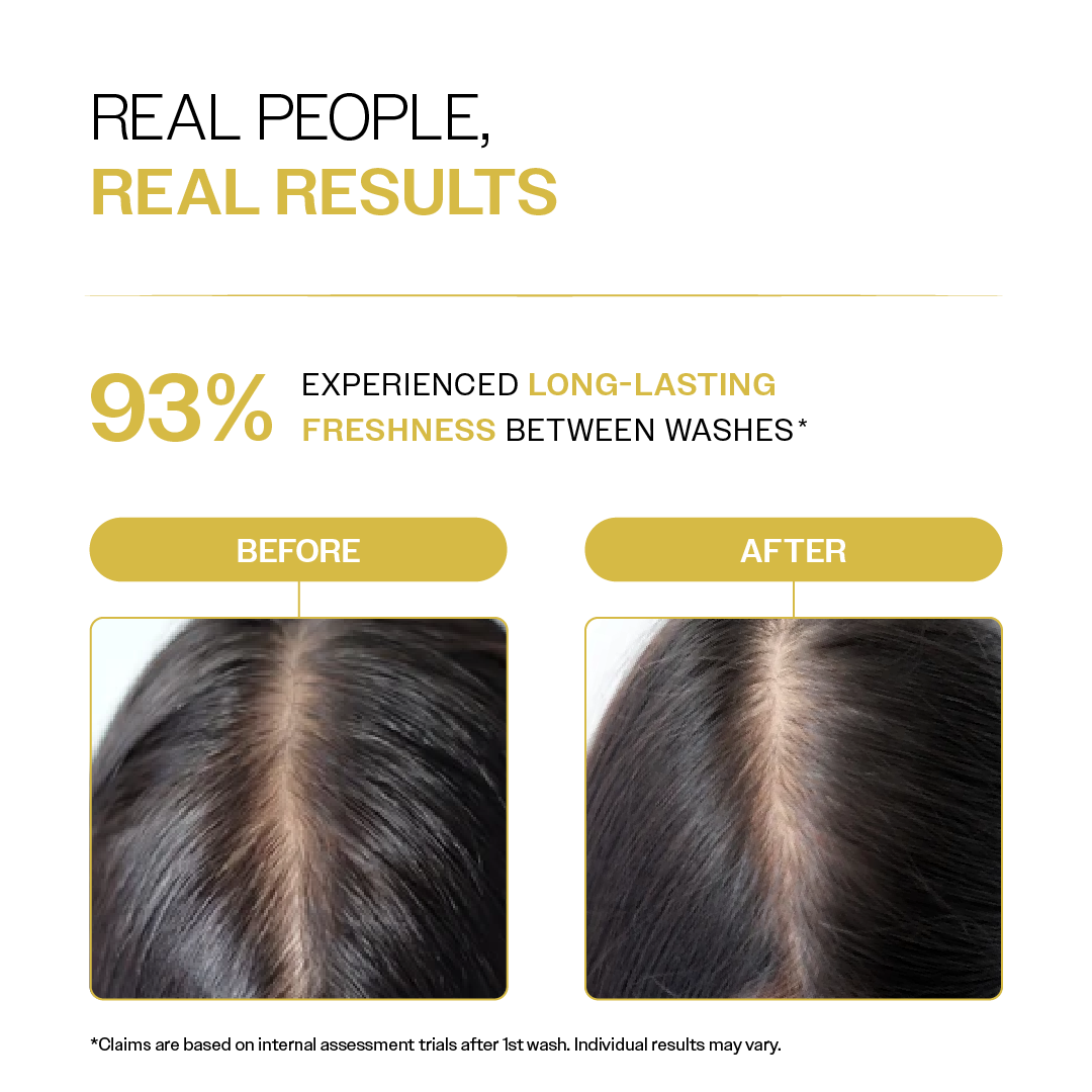Oil Control Shampoo with Salicylic Acid, Hyaluronic Acid, & Tea Tree