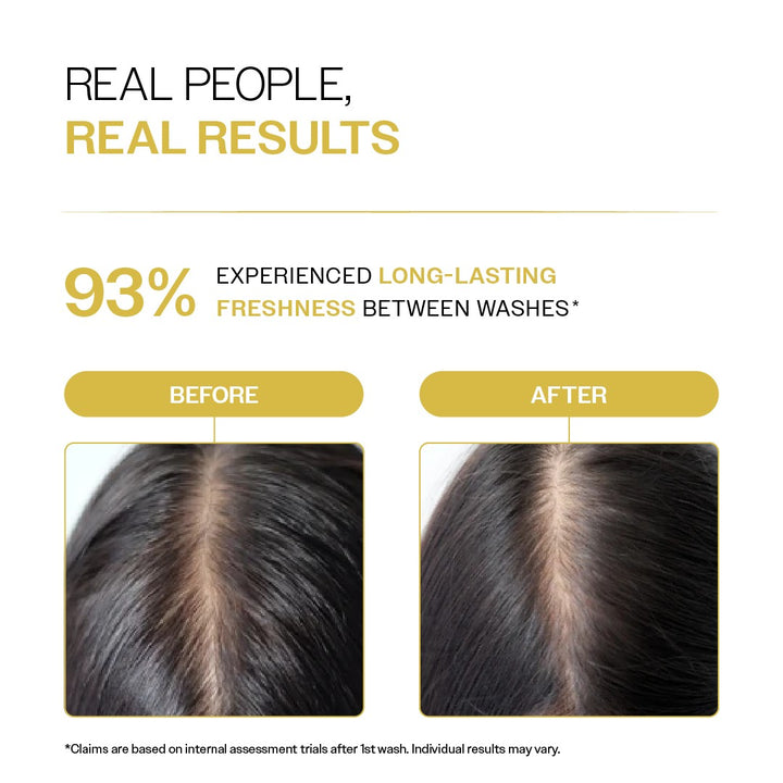 Oil Control Shampoo with Salicylic Acid, Hyaluronic Acid, & Tea Tree