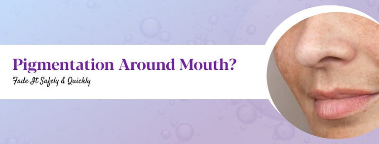 Pigmentation Around Mouth: Causes, Treatment & Prevention Tips