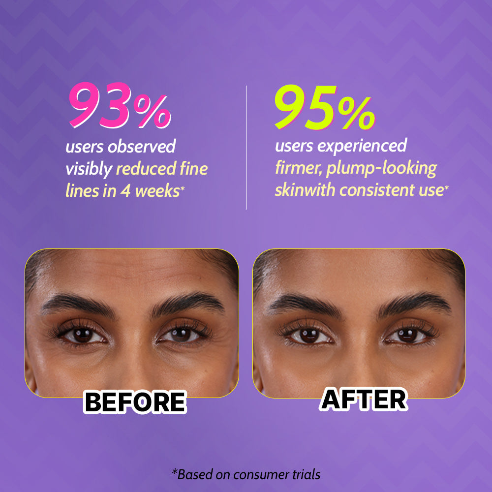 0.1% Retinol Night Cream - 30g